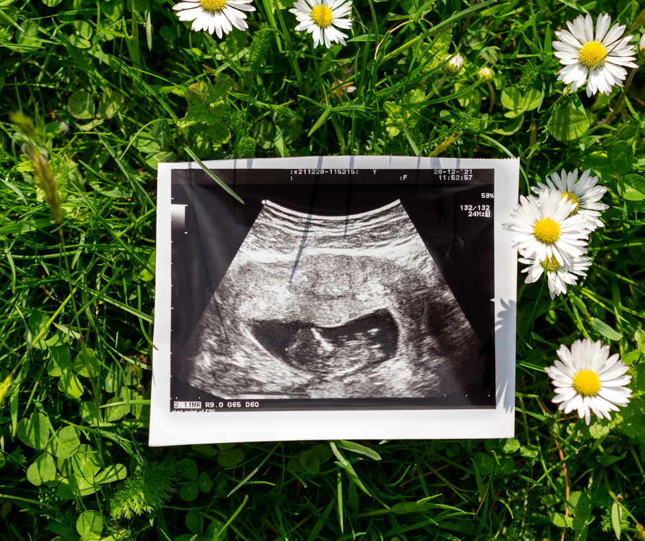 what does the bible say about abortion